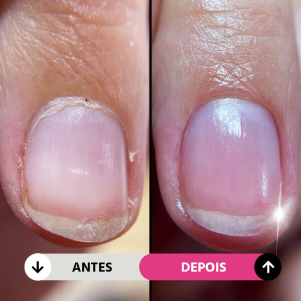 Lixa de Unha Elétrica Profissional 5 em 1 Sem Fio NailGlam - Imagem 3